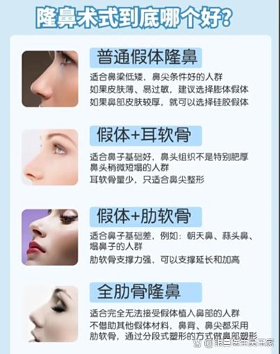 微调整形都有什么项目