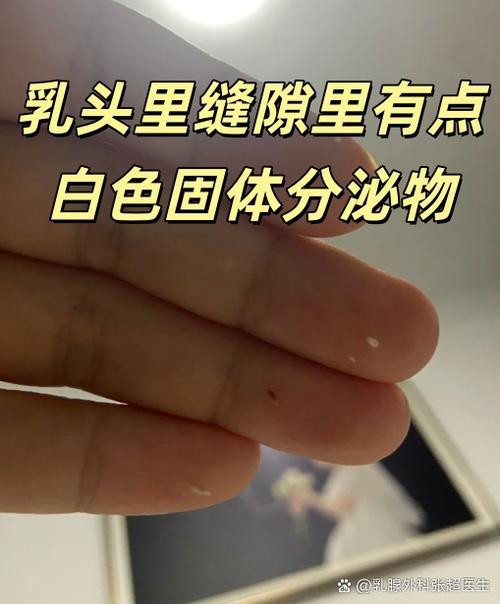 哺乳期奶孔里挤出白色东西