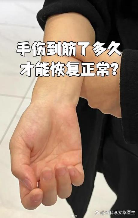 手筋自己动怎么回事