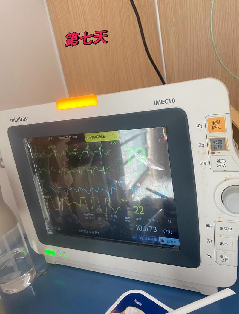 病床VAC啥意思