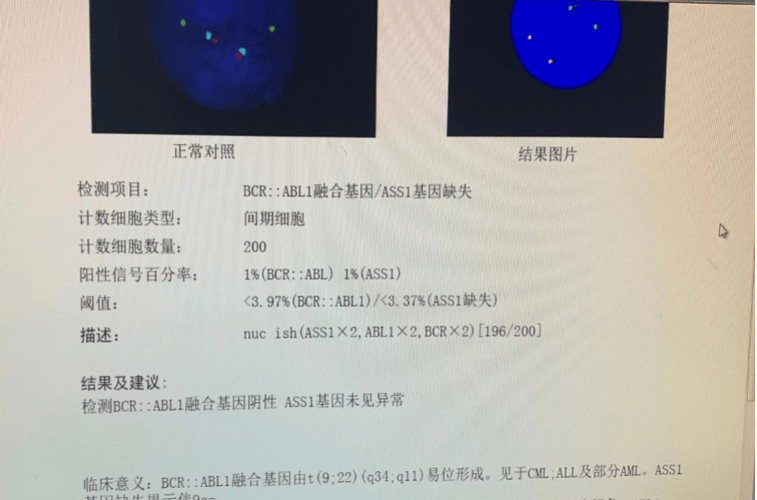 fish检测阴性说明什么截图2