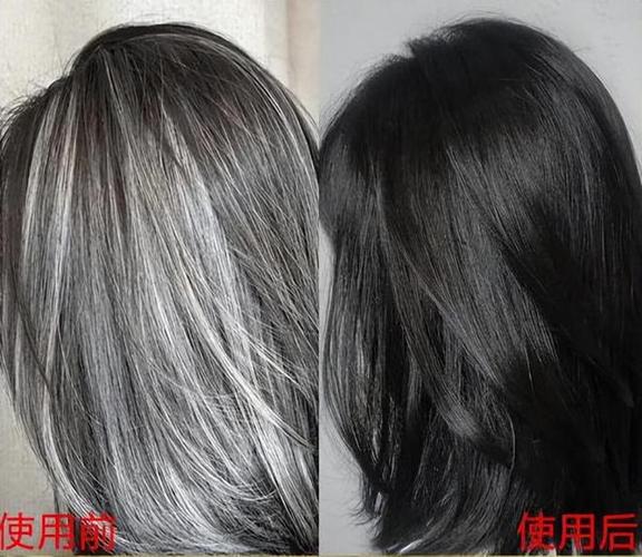 白发变黑发最好的方法
