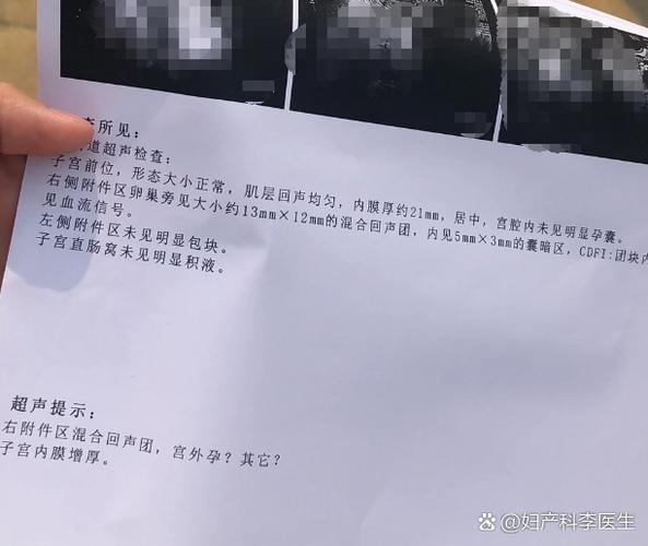 液性暗区排除出