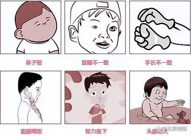 综合征漫画