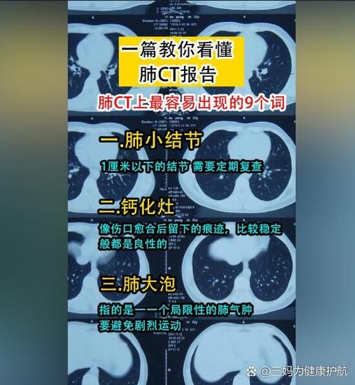 手机上怎么看ct片