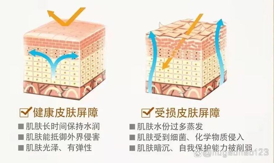 皮肤屏障受损的症状