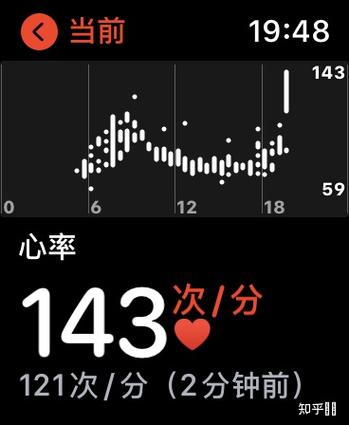 运动手表测心率准不准