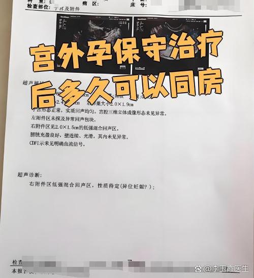 宫外孕打mtx成功率