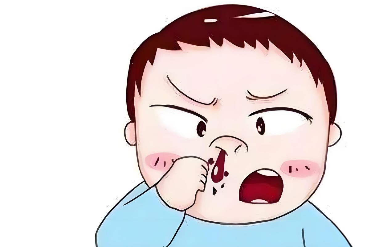 宝宝经常流鼻血是病吗