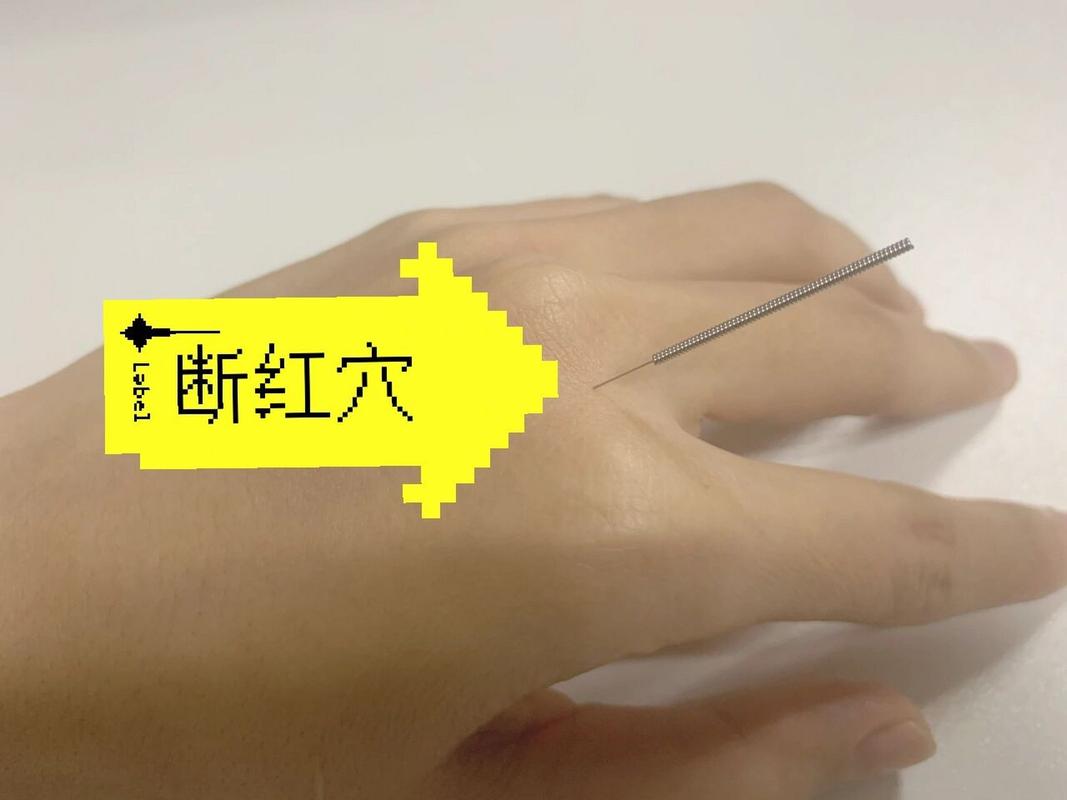 中原一点红的手怎么断