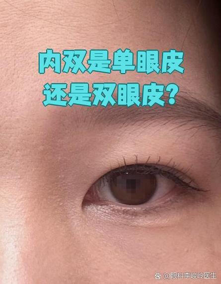 内双自己变成单了