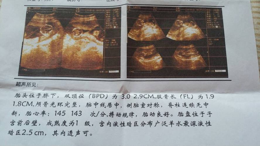 怀孕15周男女特征图