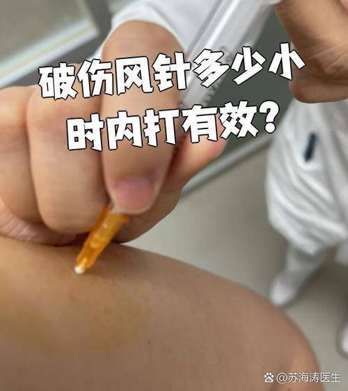 破伤风可以打肩膀吗
