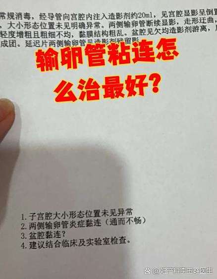 输卵管粘连最好的治疗方法