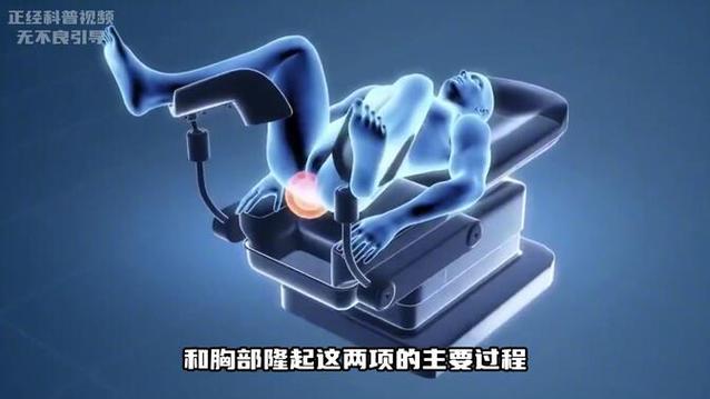 男的变女人的手术截图2