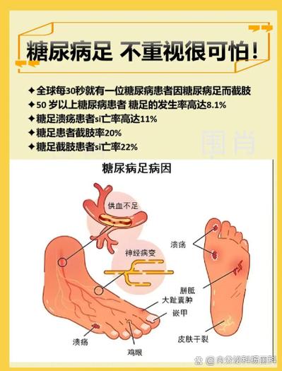糖尿病活不久的症状