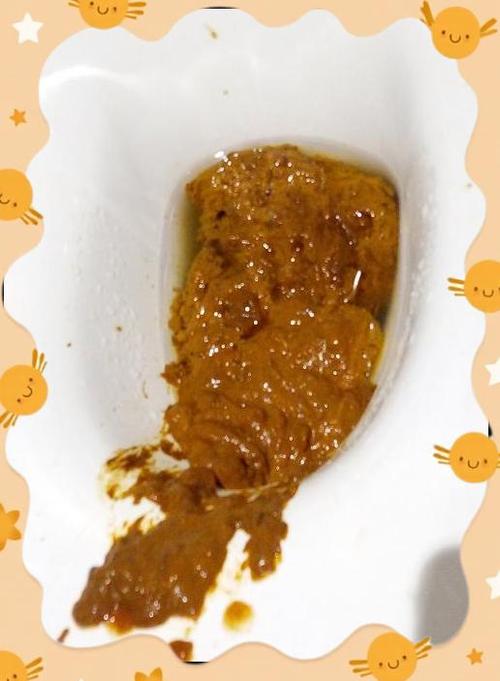 大便拉不出来