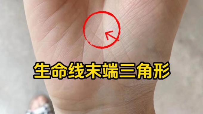 生命线末端形成三角形