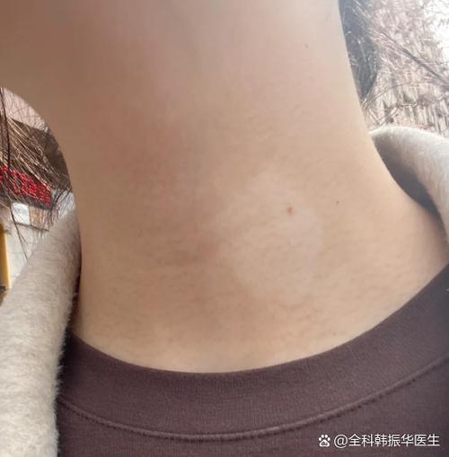 液晶电视出现白斑是什么原因