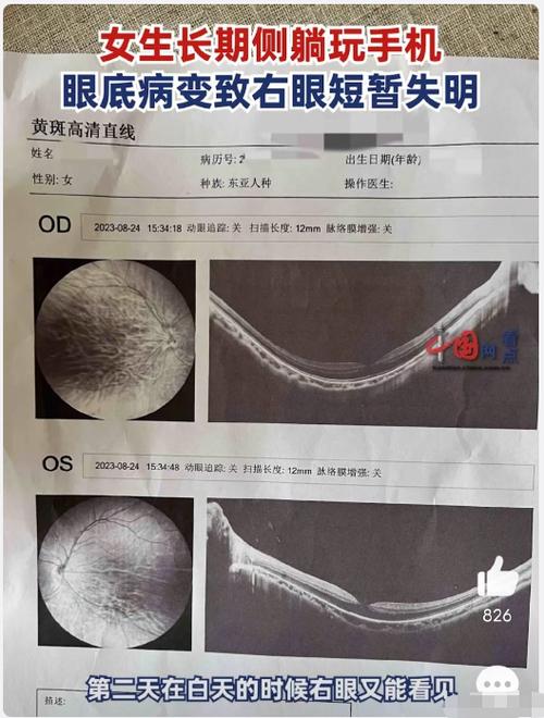 眼睛短暂失明