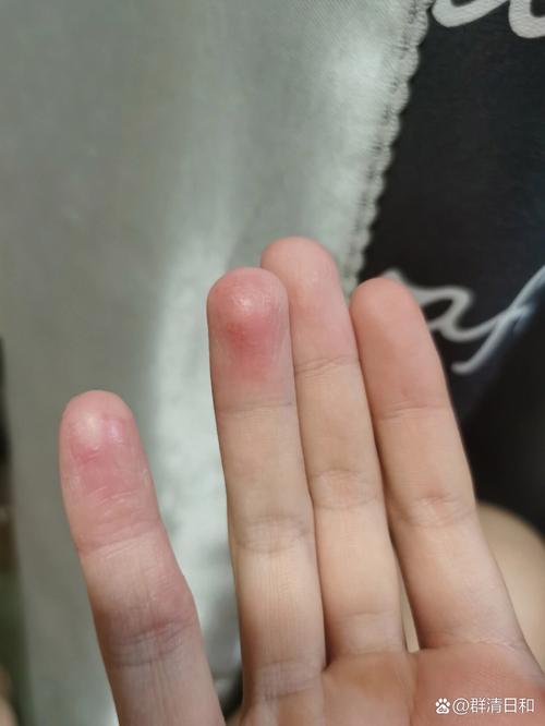 指纹用不了截图3