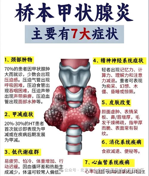 桥本甲状腺炎能治愈吗
