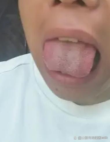 五十岁女人舌头麻是怎么回事截图3