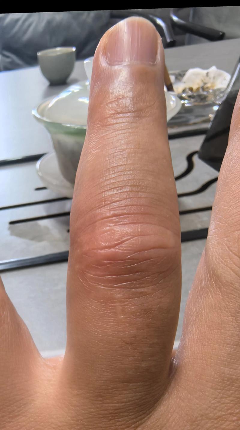 打篮球会磨损指纹嘛
