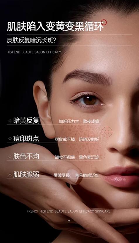 用什么去斑点最好