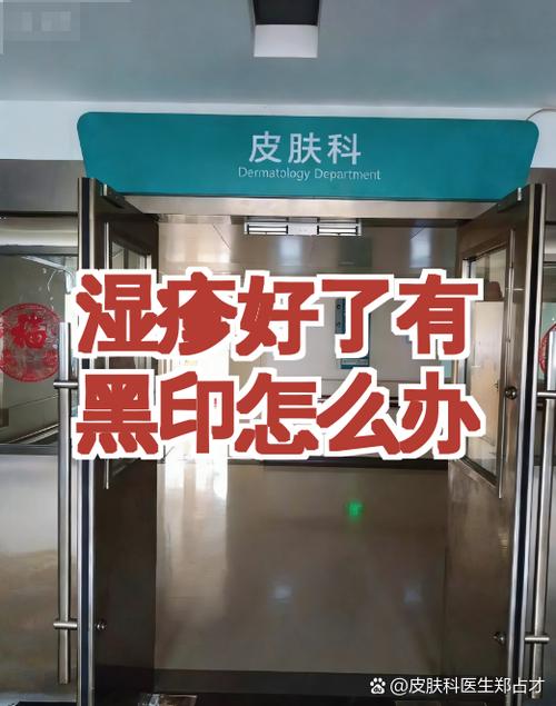 湿疹过后的黑印如何去除