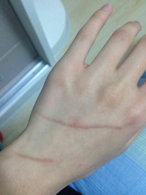 被猫抓了一条痕迹