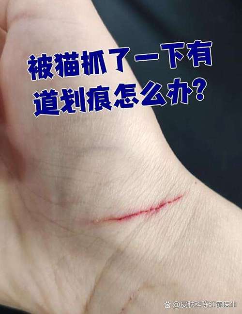 被猫抓了一条痕迹截图3