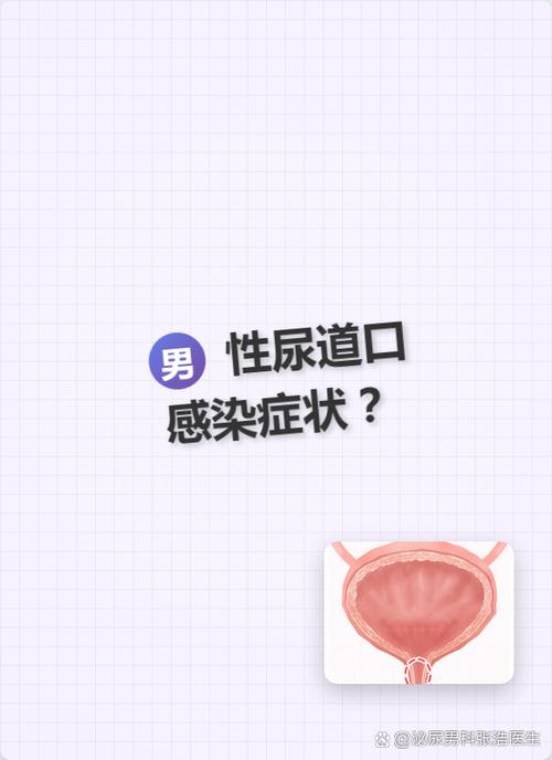 尿道口胀痛老想排尿