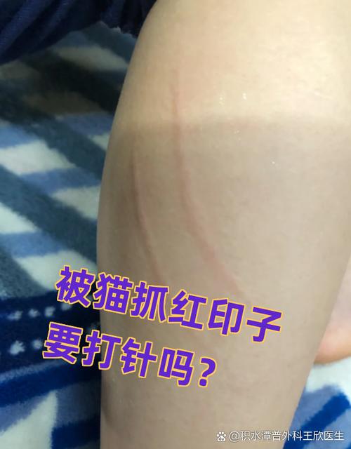 猫抓了一条红印子图片
