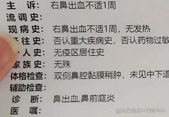 反反复复流鼻血怎么回事
