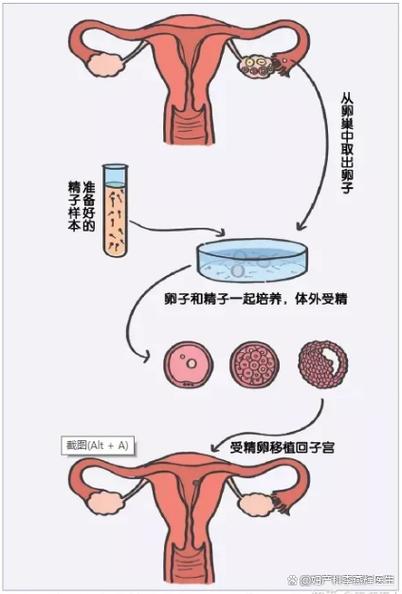 标记移植什么意思