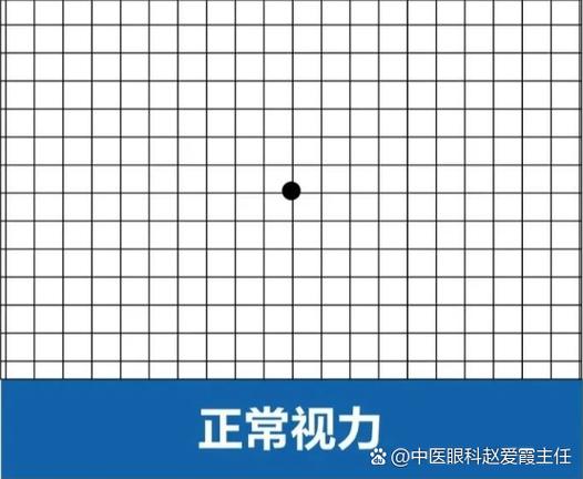 投影仪有黄斑什么原因