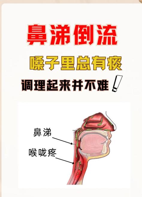 有黄鼻涕怎么治疗