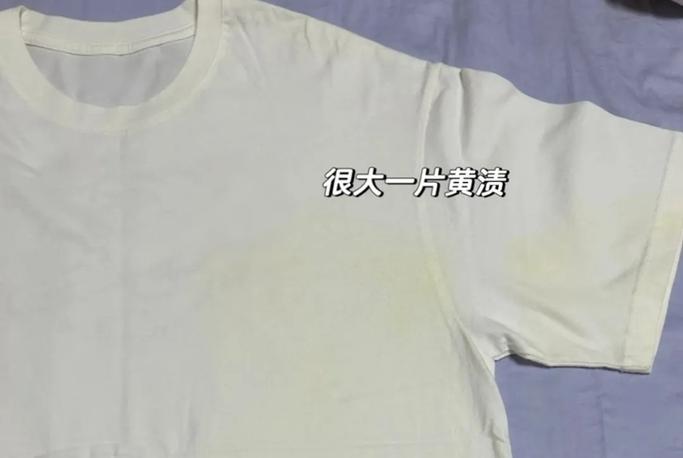 白色放久了变黄怎么办
