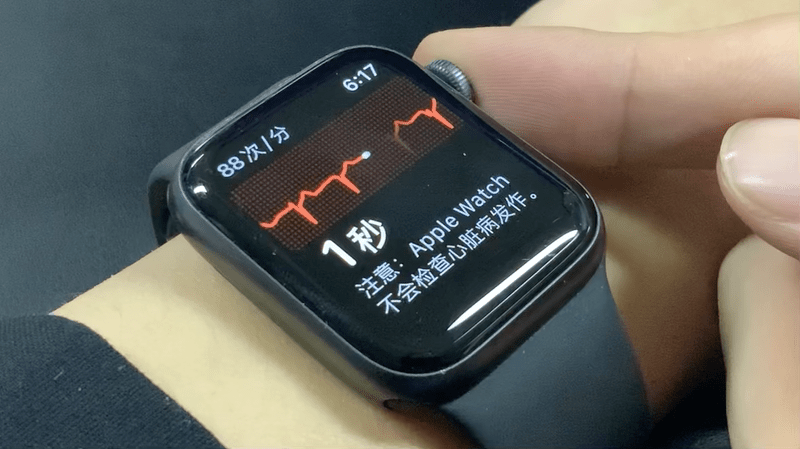 applewatch开不了机