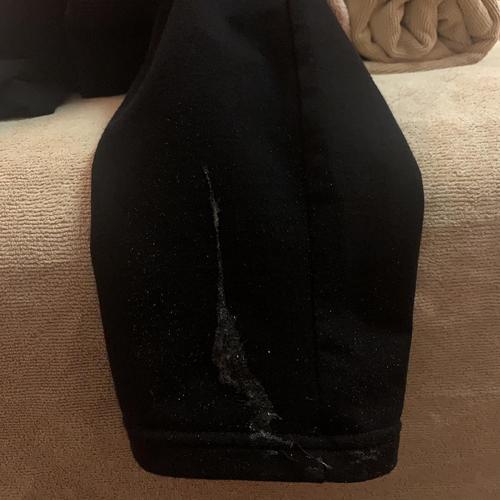 吐口水出黑色的瘀血块