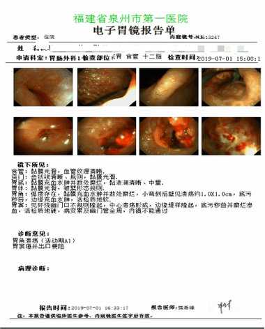 患者os是什么意思