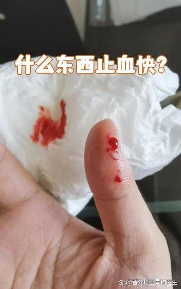 冰块能止血吗?