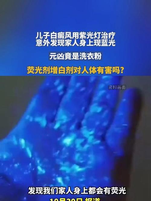 紫光灯照皮肤上白点是什么
