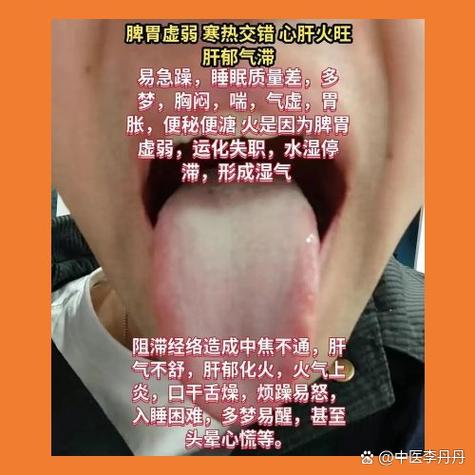 半夏泻心汤的禁忌