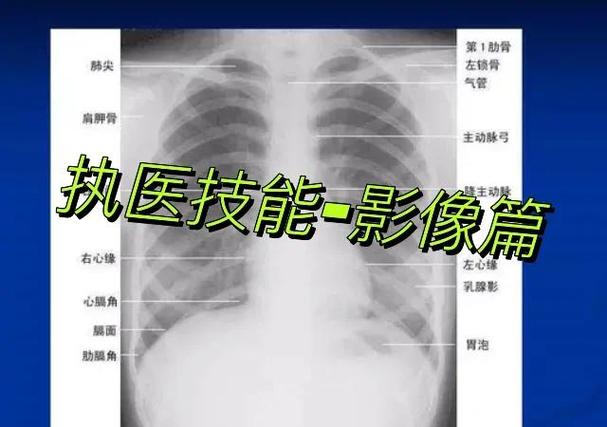 瓦怎么关x光