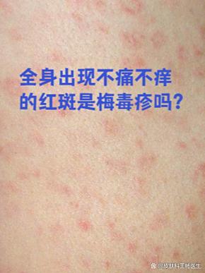 性传播的病毒感染有哪些症状