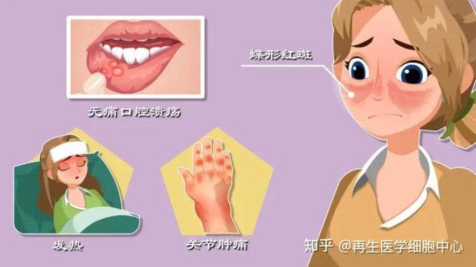 如何避免红斑狼疮
