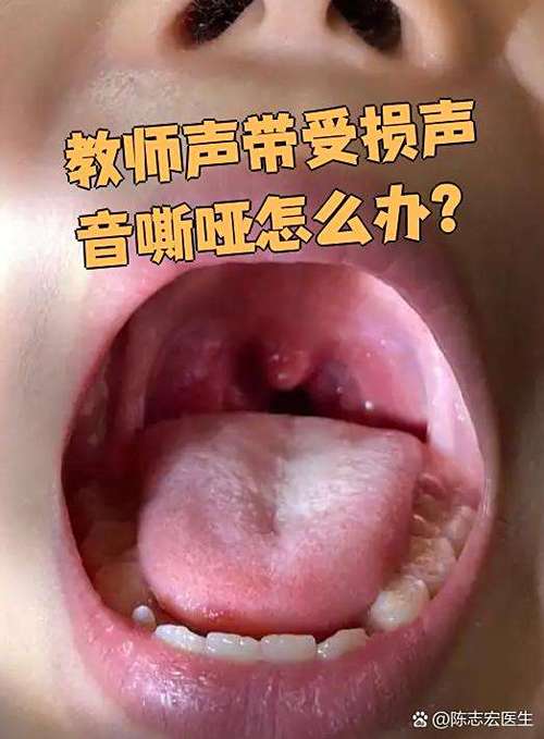 唱歌声音刺耳怎么办