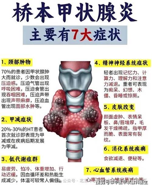 桥本病有什么症状